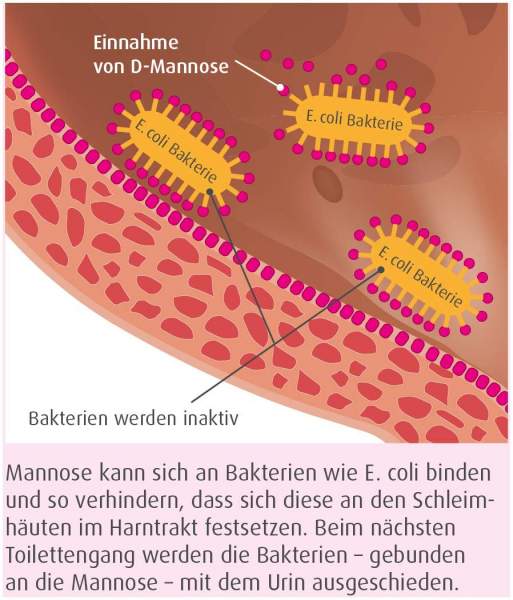 Urocys Mannose+ 15 Sticks kaufen Volksversand Versandapotheke