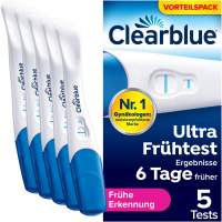gestreifte handschuhe FDGGT 1 Paar Kniestrümpfe Und 1 Paar Gestreifte Handschuhe, Mädchenstrümpfe, Elastische Water Bottleocken, Fingerlose Handschuhe, Lange Strickhandschuhe Fashion Auto anmelden, abmelden, ummelden, Trendy ModeS dames wol appaloosa build Größe:USA 4