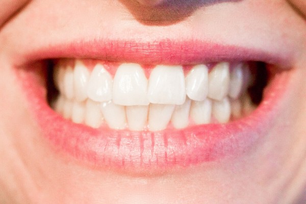 Lächelnde Frau symbolisiert Zahngesundheit