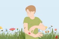 Eine llustration eines Mannes, der in einem Blumenfeld steht und von einer Biene in den Arm gestochen wurde. Der Arm ist rot und angeschwollen.