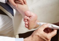 Arzt testet bei diabetischer Polyneuropathie die Nervenfunktion am Fuß.